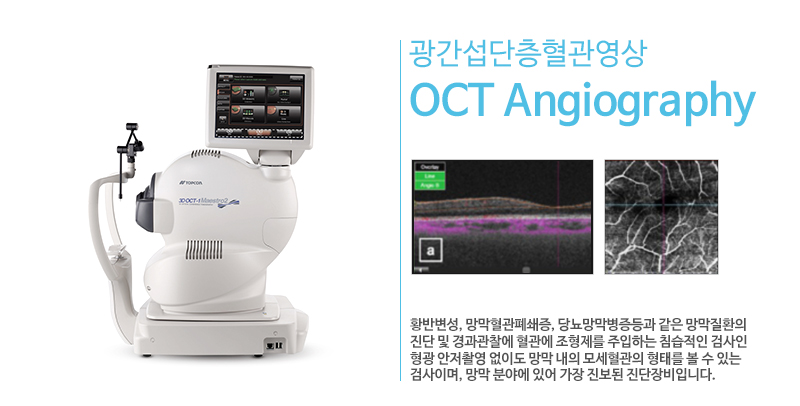 OCT Angiography ()